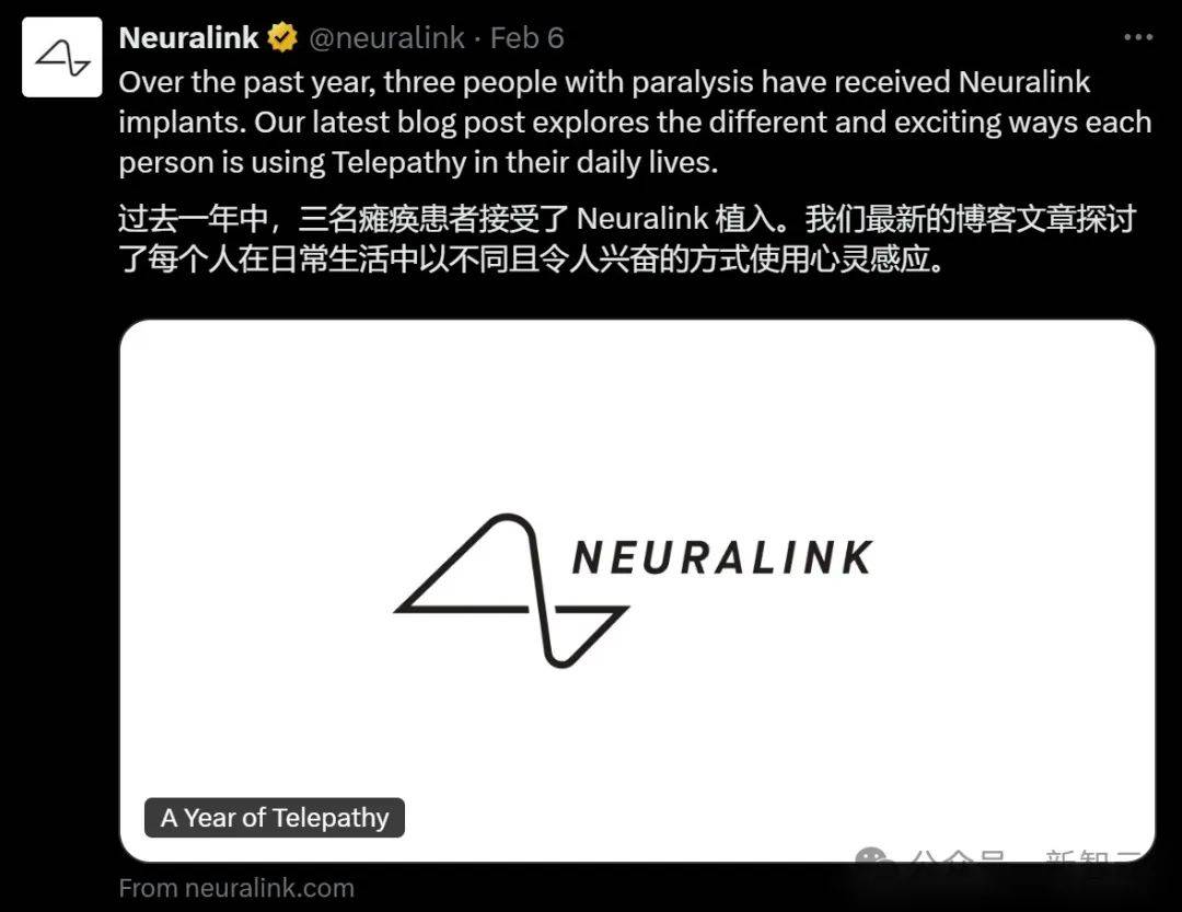 2025年，Neuralink努力实现为20至30名患者植入脑机接口设备的目标_国内首例植入式脑机接口_脑机接口植入技术的植入期限是